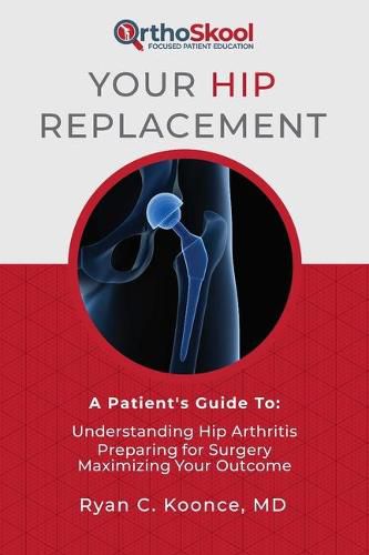 Cover image for Your Hip Replacement: A Patient's Guide To: Understanding Hip Arthritis, Preparing for Surgery, Maximizing Your Outcome