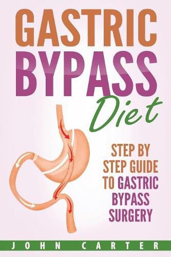 Cover image for Gastric Bypass Diet: Step By Step Guide to Gastric Bypass Surgery