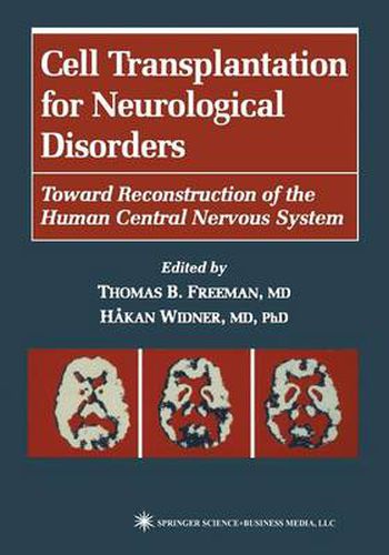 Cover image for Cell Transplantation for Neurological Disorders: Toward Reconstruction of the Human Central Nervous System