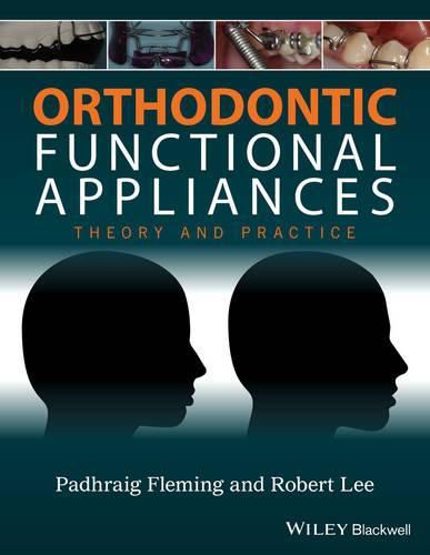 Cover image for Orthodontic Functional Appliances - Theory and Practice