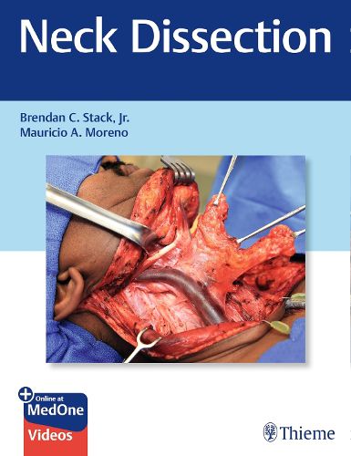 Cover image for Neck Dissection
