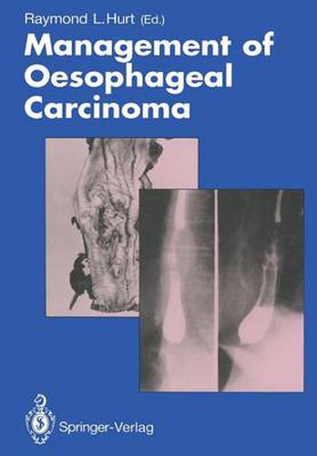 Cover image for Management of Oesophageal Carcinoma