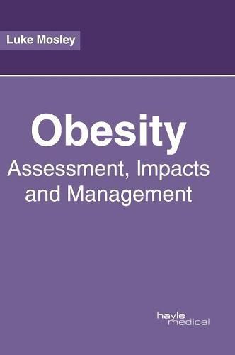 Cover image for Obesity: Assessment, Impacts and Management