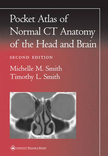 Cover image for Pocket Atlas of Normal CT Anatomy of the Head and Brain