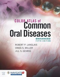 Cover image for Color Atlas Of Common Oral Diseases, Enhanced Edition