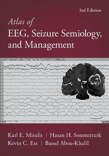 Cover image for Atlas of EEG, Seizure Semiology, and Management