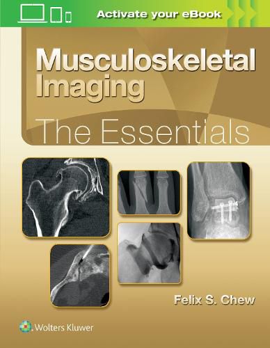 Cover image for Musculoskeletal Imaging: The Essentials