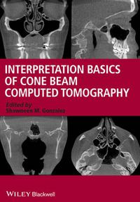 Cover image for Interpretation Basics of Cone Beam Computed Tomography