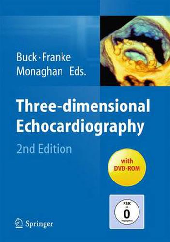 Cover image for Three-dimensional Echocardiography