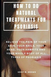 Cover image for How to Do Natural Treatments for Psoriasis: Relieve the Pain of Your Skin, Your Nails, Your Head, Your Armpits and Your Whole Body of All Types of Psoriasis
