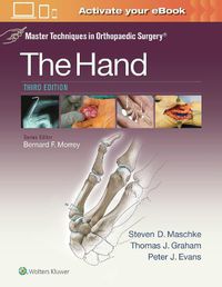 Cover image for Master Techniques in Orthopaedic Surgery: The Hand