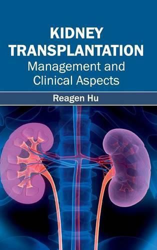 Cover image for Kidney Transplantation: Management and Clinical Aspects