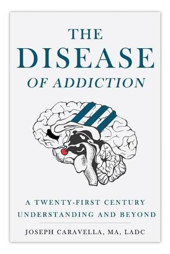 Cover image for The Disease of Addiction: A Twenty-First Century Understanding and Beyond
