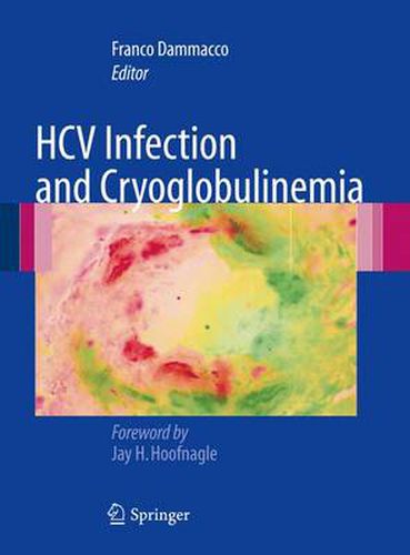Cover image for HCV Infection and Cryoglobulinemia