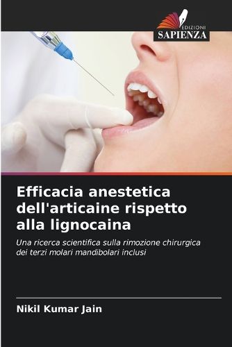Cover image for Efficacia anestetica dell'articaine rispetto alla lignocaina