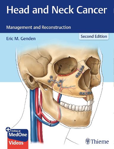 Cover image for Head and Neck Cancer: Management and Reconstruction