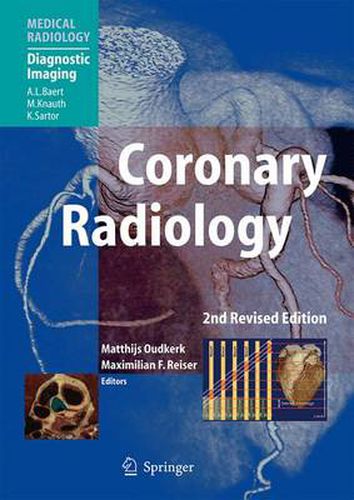 Cover image for Coronary Radiology