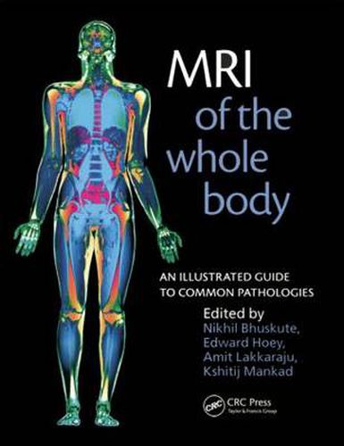 Cover image for MRI of the Whole Body: An Illustrated Guide for Common Pathologies