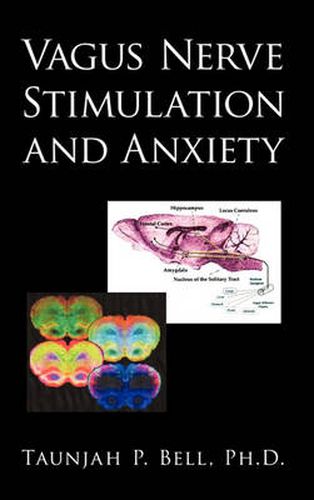 Cover image for Vagus Nerve Stimulation and Anxiety