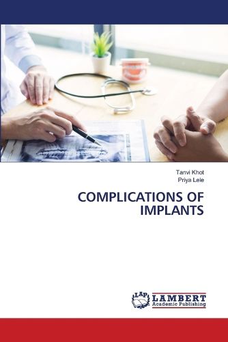 Cover image for Complications of Implants