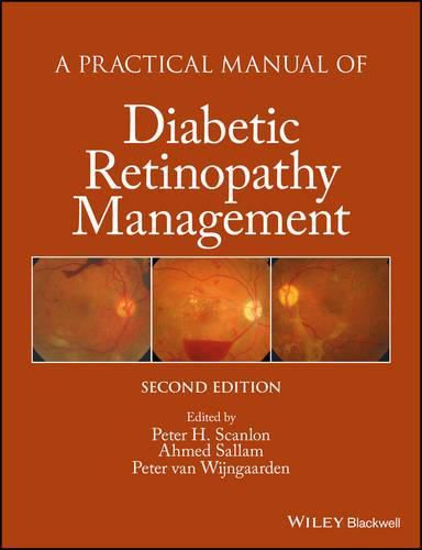 Cover image for A Practical Manual of Diabetic Retinopathy Management