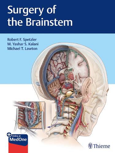 Cover image for Surgery of the Brainstem