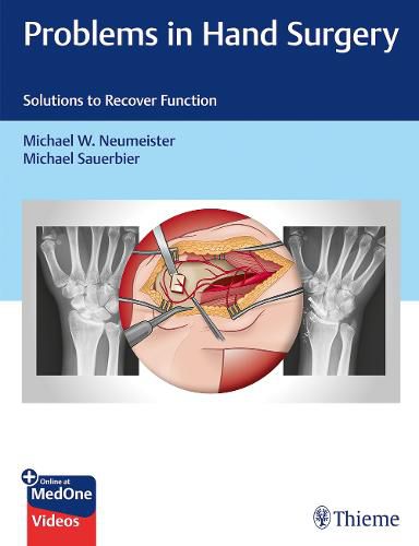 Cover image for Problems in Hand Surgery: Solutions to Recover Function