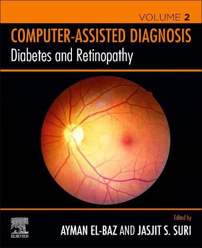 Cover image for Diabetes and Retinopathy