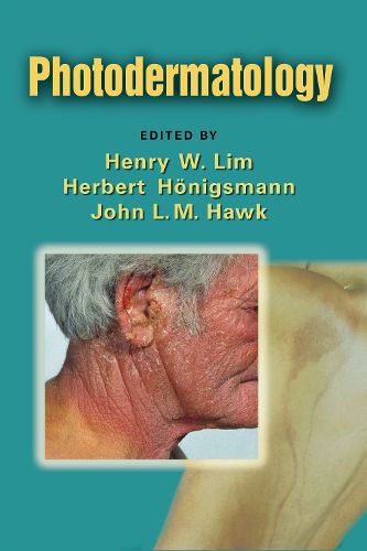 Cover image for Photodermatology