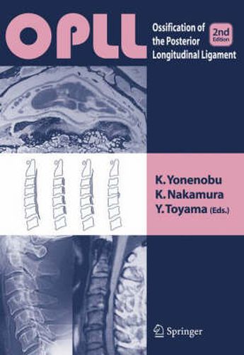 Cover image for OPLL: Ossification of the Posterior Longitudinal Ligament