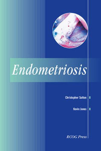 Cover image for Endometriosis