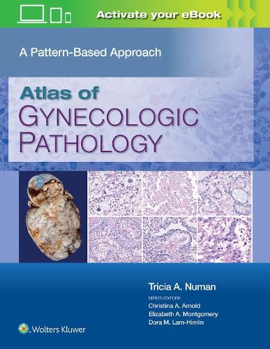 Cover image for Atlas of Gynecologic Pathology: A Pattern Based Approach