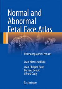 Cover image for Normal and Abnormal Fetal Face Atlas: Ultrasonographic Features