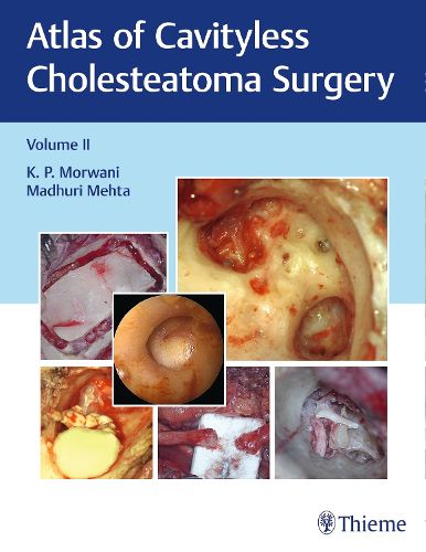 Cover image for Atlas of Cavityless Cholesteatoma Surgery, Vol 2