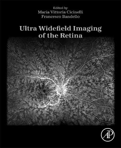 Cover image for Ultra Widefield Imaging of the Retina
