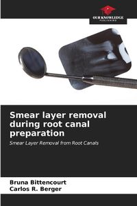 Cover image for Smear layer removal during root canal preparation