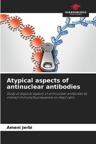 Cover image for Atypical aspects of antinuclear antibodies