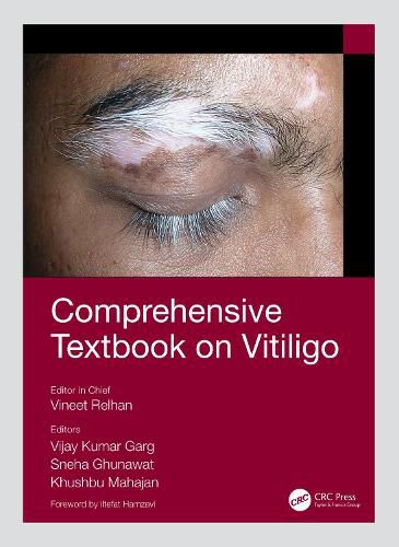 Cover image for Comprehensive Textbook on Vitiligo