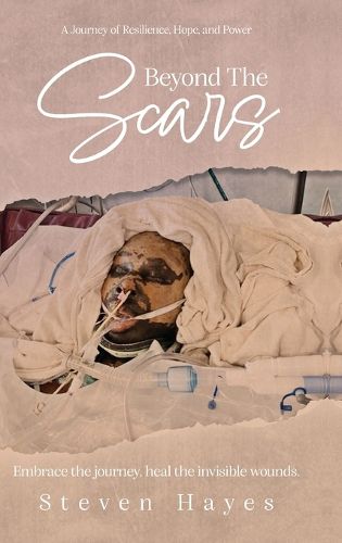 Cover image for Beyond The Scars