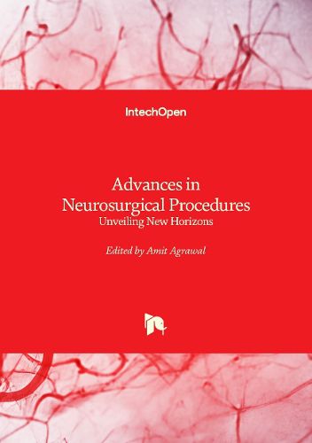 Cover image for Advances in Neurosurgical Procedures