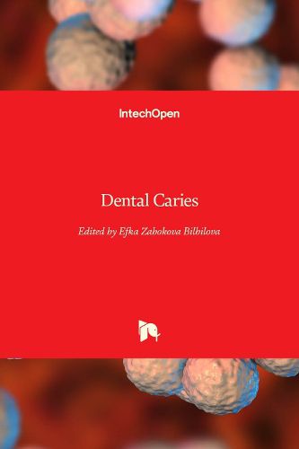 Cover image for Dental Caries