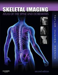 Cover image for Skeletal Imaging: Atlas of the Spine and Extremities
