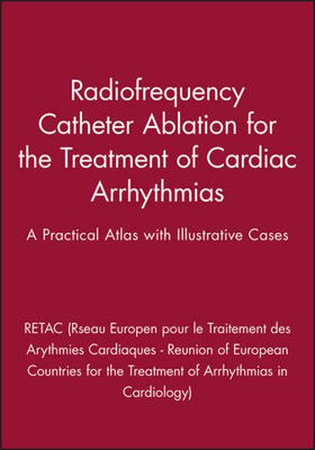 Cover image for Radiofrequency Catheter Ablation