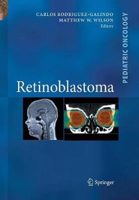 Cover image for Retinoblastoma