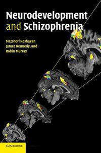 Cover image for Neurodevelopment and Schizophrenia