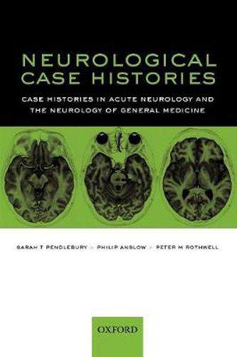 Cover image for Neurological Case Histories: Case Histories in Acute Neurology and the Neurology of General Medicine