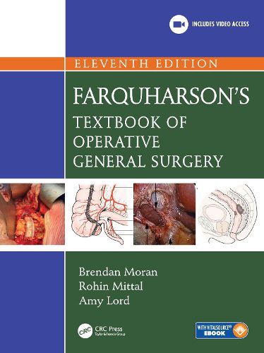 Cover image for Farquharson's Textbook of Operative General Surgery