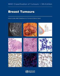 Cover image for WHO Classification of Breast Tumours: WHO Classification of Tumours, Volume 2