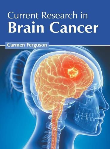 Cover image for Current Research in Brain Cancer