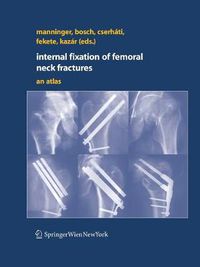 Cover image for Internal fixation of femoral neck fractures: An Atlas